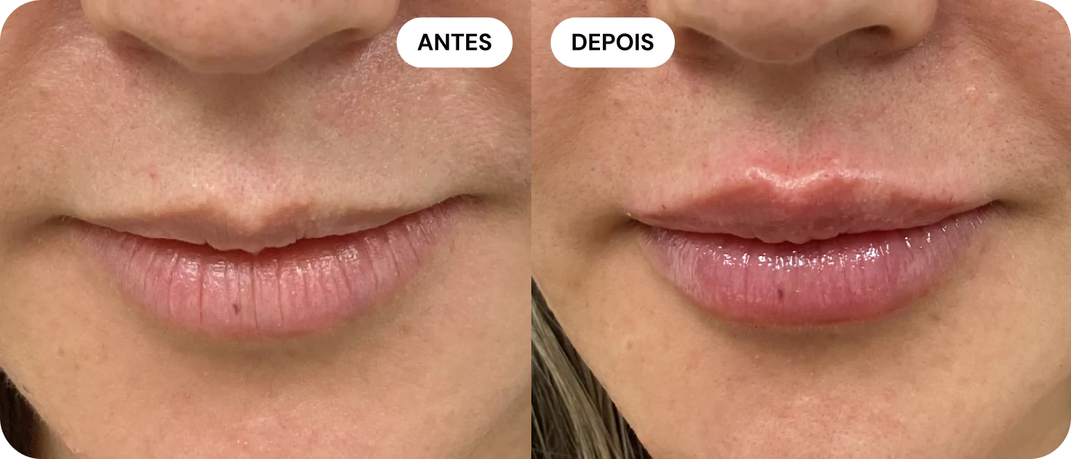 1-antes-e-depois-1-68014cd41e110