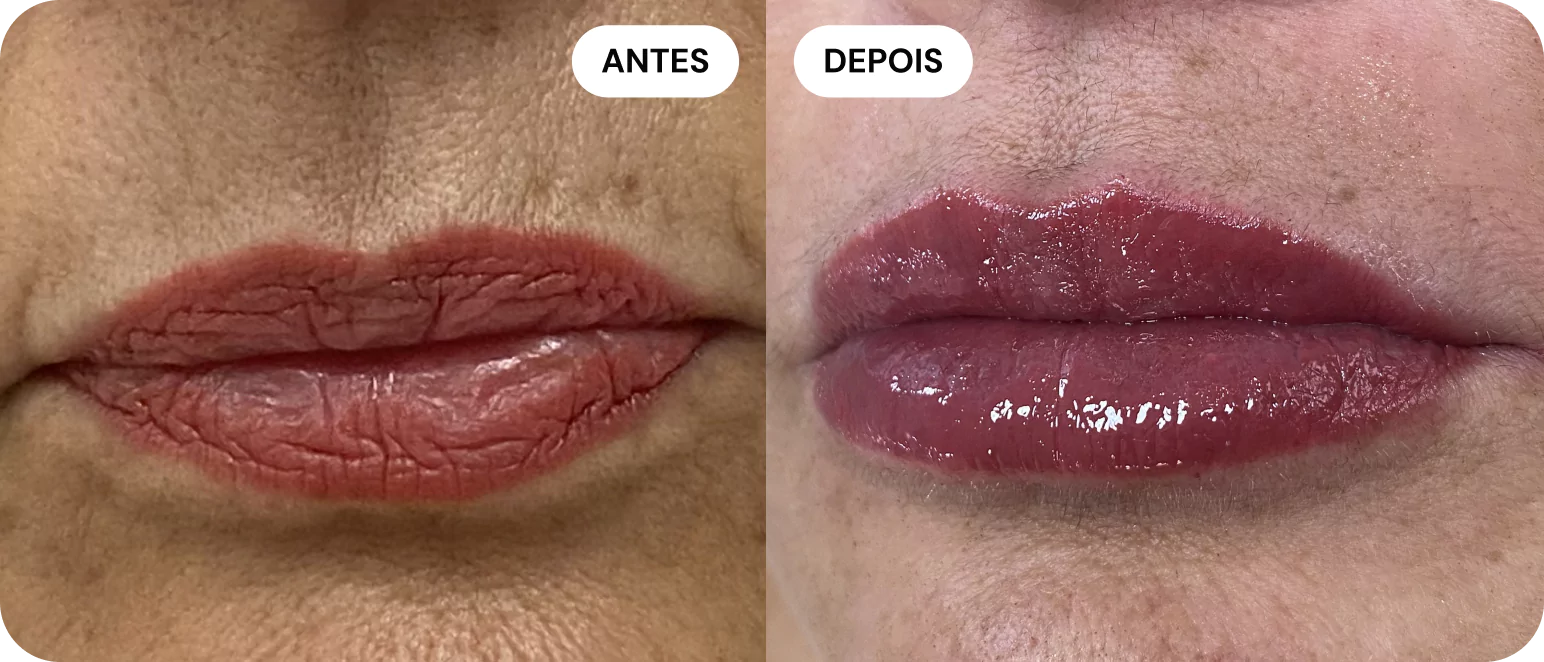 1-antes-e-depois-2-68014cd423d65