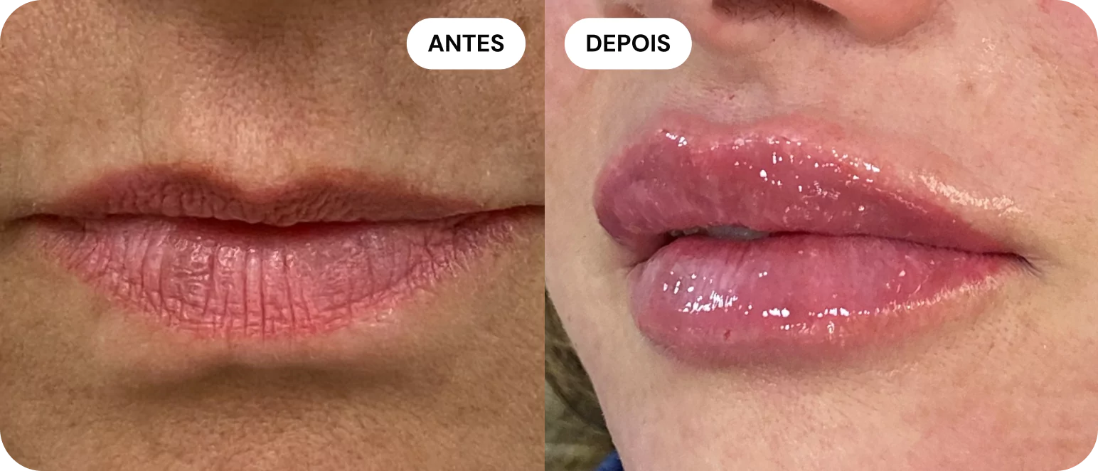 1-antes-e-depois-3-68014cd6b26e0