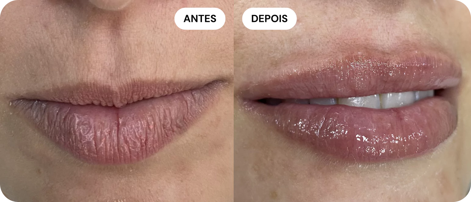 1-antes-e-depois-4-68014cd70386a