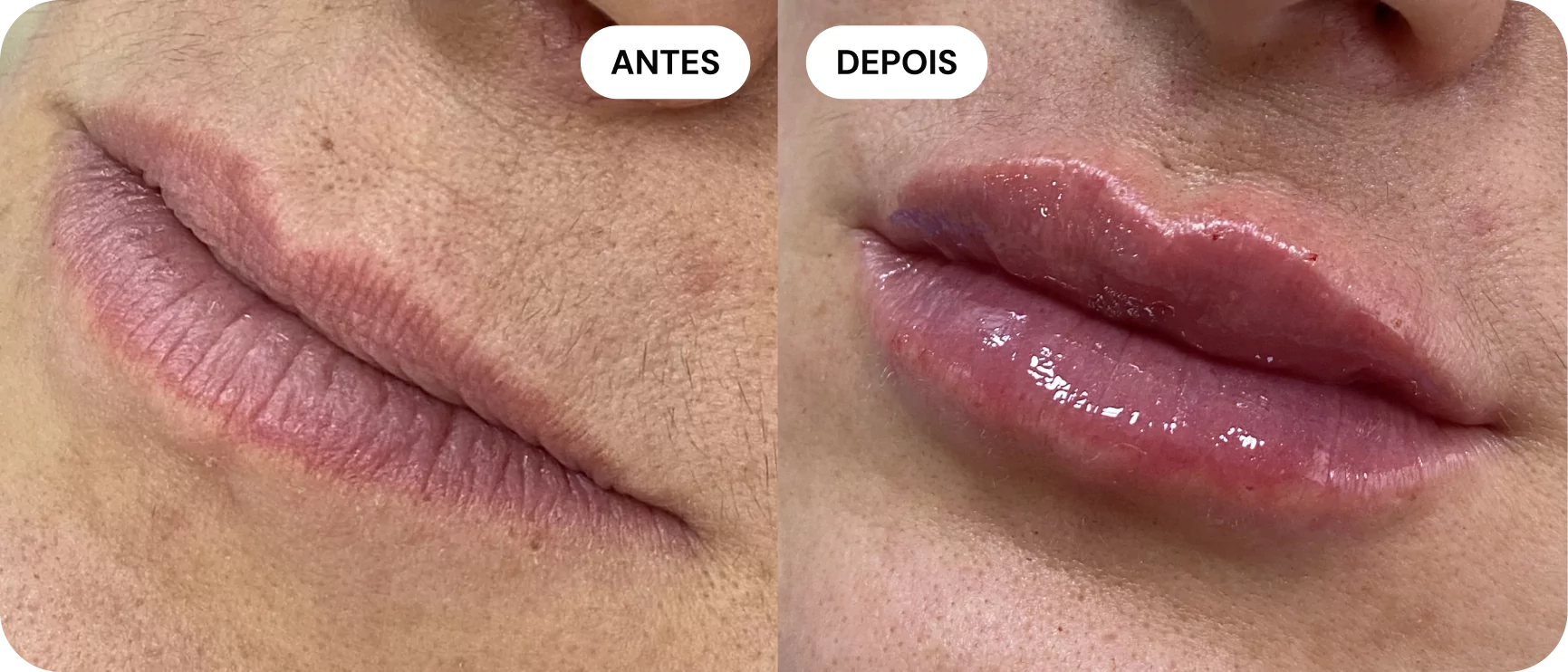 1-antes-e-depois-68014cd991717